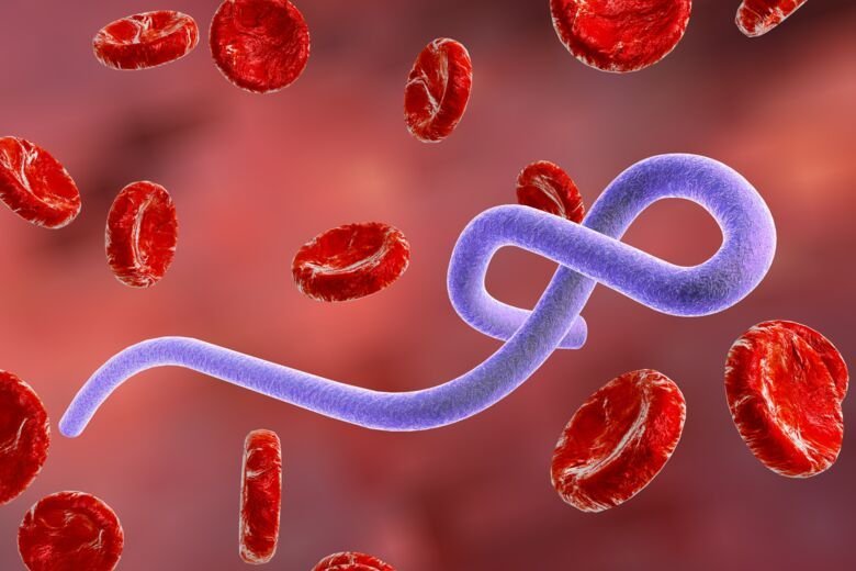 Ebola case in the US by June 30? card icon